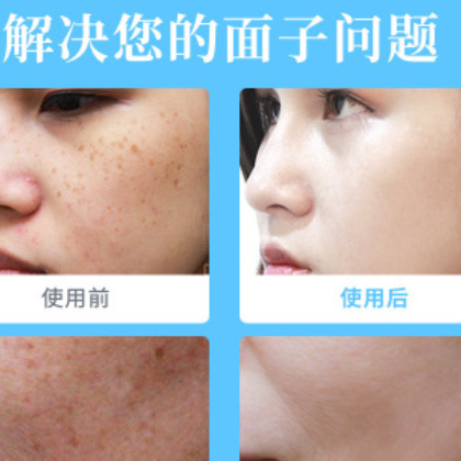 苏小记祛斑霜 解决各种色斑雀斑妊娠斑晒斑老年斑黄褐斑 面霜批发图2
