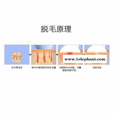 广州欧的美容仪器多功能OPT冰点无痛快速脱毛仪  脱毛嫩肤美白祛斑图3