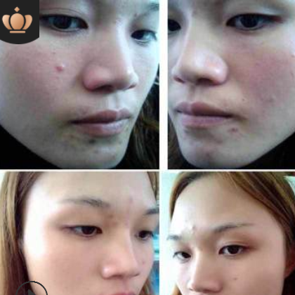 萌米384蚕丝大米面膜孕妇敏感肌补水保湿修护肌肤嫩肌肤 免洗图2