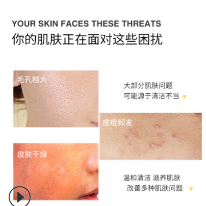 跨境直供货源金丝菊氨基酸洁面皂 补水清洁保湿手工精油皂OEM订制图2