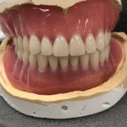 深圳假牙种植牙义齿加工厂家_OEM定制出口